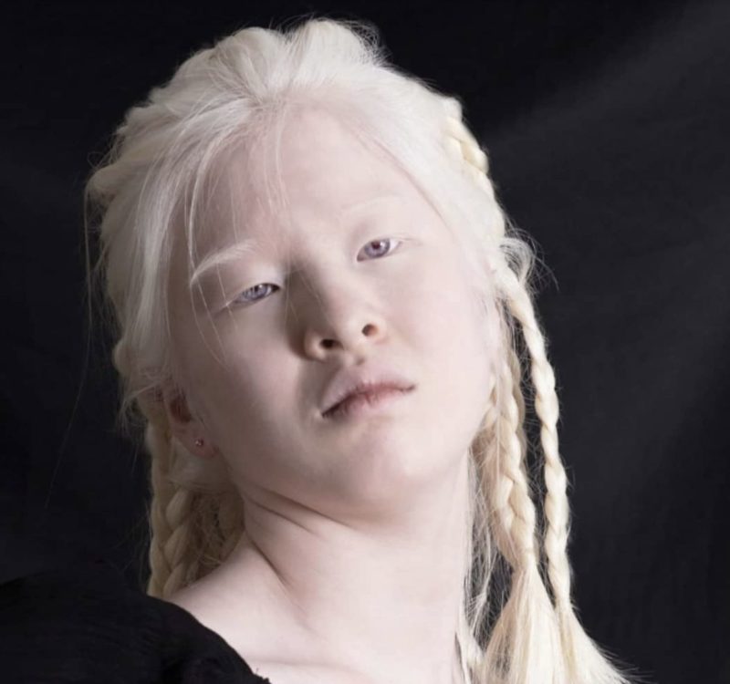 Cómo la chica única abandonada se convirtió en una modelo de Vogue y lo que desea transmitir...