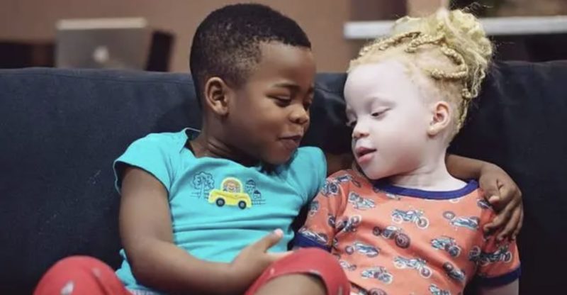 La mamá de los gemelos "Blanco y Negro" dice que la gente no cree que ella sea su madre... Mira el adorable video para ver cómo les enseña a abrazar su singularidad.