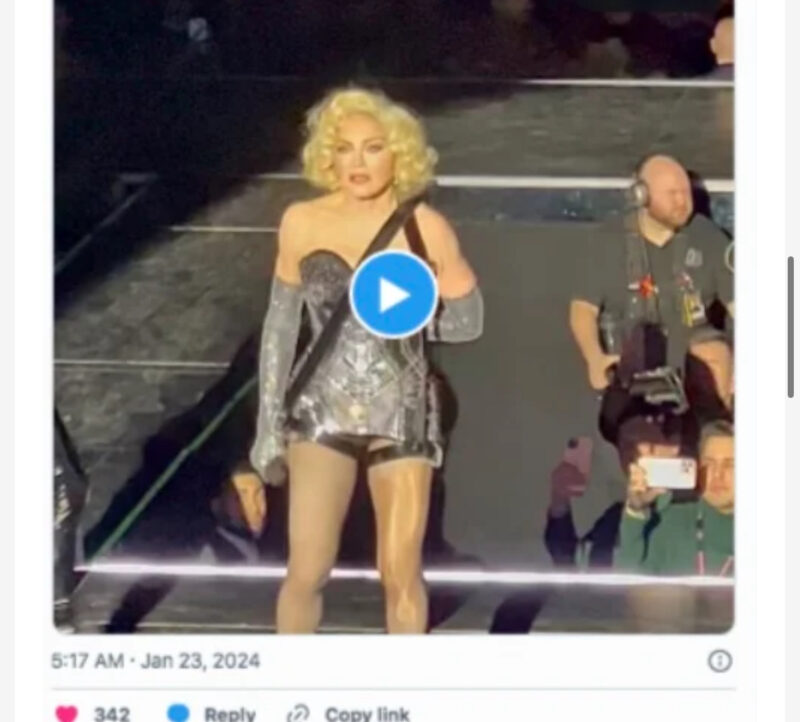 Los fanáticos quedaron en shock por la nueva apariencia del cantante durante el reciente concierto.