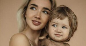 ¡Madre heroína! La mamá cuenta cómo no rendirse, incluso si tu hijo tiene un diagnóstico aterrador. ¡Un niño con un rostro único!