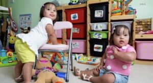 ¡Cómo han cambiado las gemelas con síndrome de Down y en qué están ocupadas ahora! ¡Datos interesantes sobre ellas!