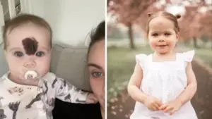 Se burlaban de la apariencia de esta pequeña niña; ahora, a la edad de 2 años, ella es "hermosa" después de que sus padres tomaran una decisión valiente.