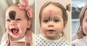 Se burlaban de la apariencia de esta pequeña niña; ahora, a la edad de 2 años, ella es "hermosa" después de que sus padres tomaran una decisión valiente.