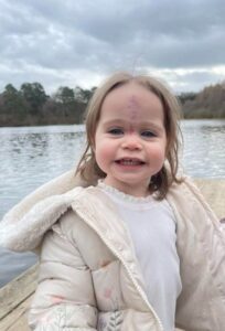 Se burlaban de la apariencia de esta pequeña niña; ahora, a la edad de 2 años, ella es "hermosa" después de que sus padres tomaran una decisión valiente.