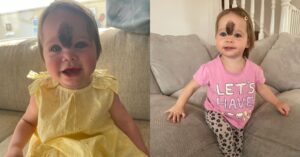 Se burlaban de la apariencia de esta pequeña niña; ahora, a la edad de 2 años, ella es "hermosa" después de que sus padres tomaran una decisión valiente.